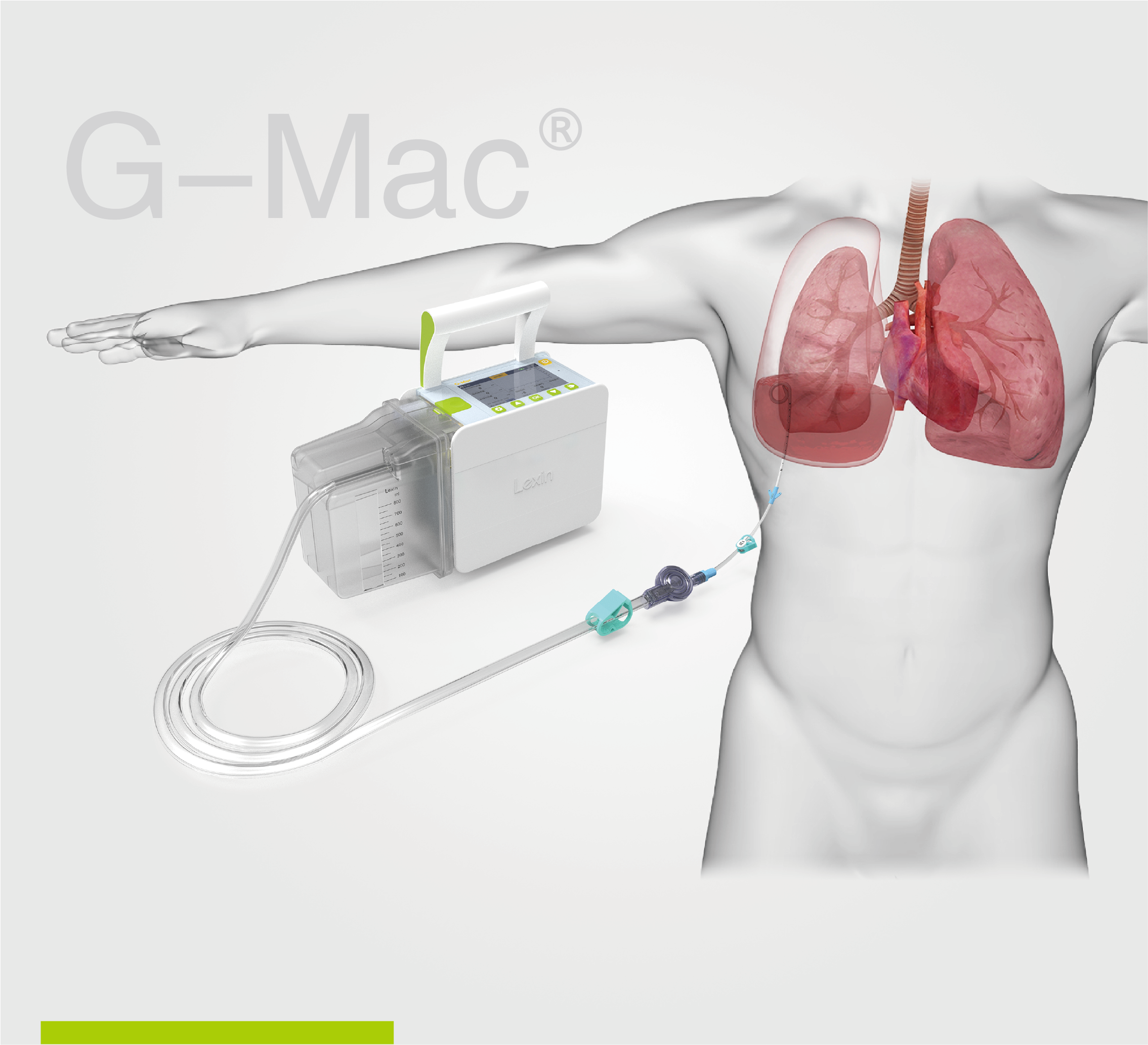 【火熱招商】樂信數字化醫療器械(線上)展 —— 第二期 · 胸腔引流監控系統 G-Mac?